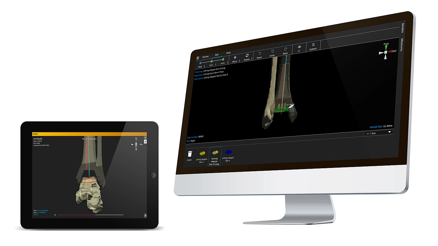 Stryker Prophecy 3D Planning System