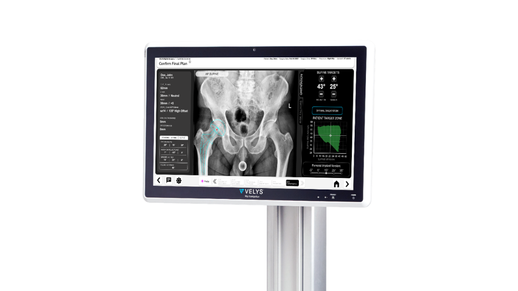 VELYS Hip Navigation digital surgical system